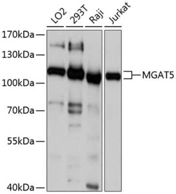 Western Blot: N-Acetylglucosaminyltransferase V/MGAT5 Antibody [NBP2-94188] - Western blot analysis of extracts of various cell lines, using N-Acetylglucosaminyltransferase V/MGAT5 antibody (NBP2-94188) at 1:1000 dilution. Secondary antibody: HRP Goat Anti-Rabbit IgG (H+L) at 1:10000 dilution. Lysates/proteins: 25ug per lane. Blocking buffer: 3% nonfat dry milk in TBST. Detection: ECL Basic Kit. Exposure time: 1s.